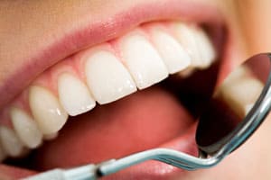 Healthy Smile