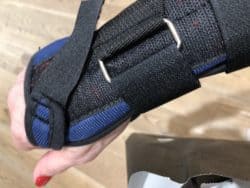 after hurting my wrist