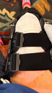 brace on knee